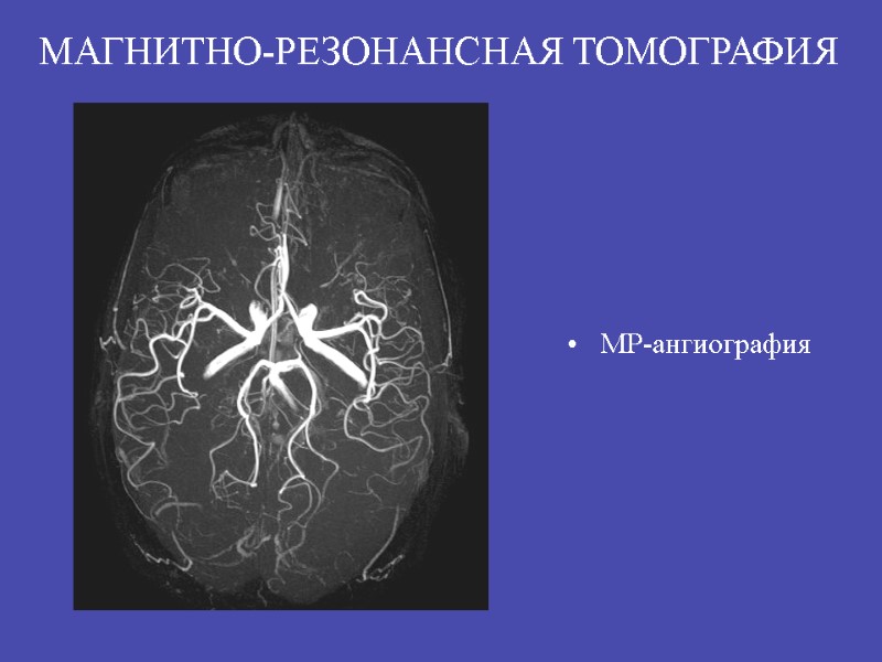 МР-ангиография  МАГНИТНО-РЕЗОНАНСНАЯ ТОМОГРАФИЯ